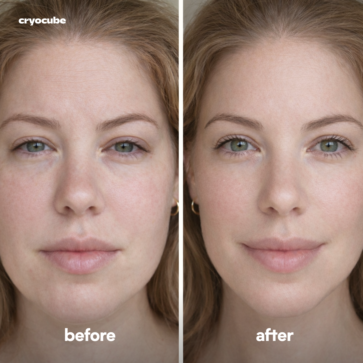 Cryocube™ Instant De-Puffing Ice Roller